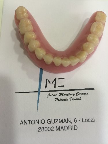 Trabajo2 Protesis dental - Jaime Martinez Cervera
