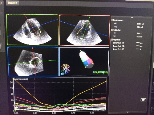 Trabajo3 Cardiologia clinica - laboratorio clínico  en Zapopan Guadalajara - Cardiologia Miramar