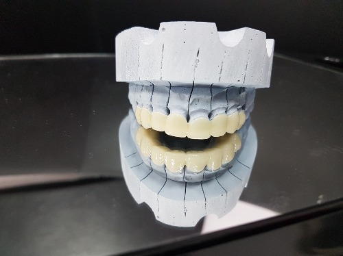 Trabajo1 Protésico dental  en MADRID Madrid - Fernando Hita