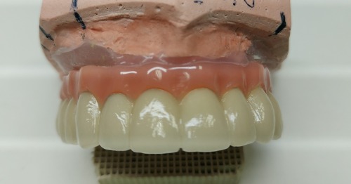 Trabajo2 Protésico dental - Fernando Hita