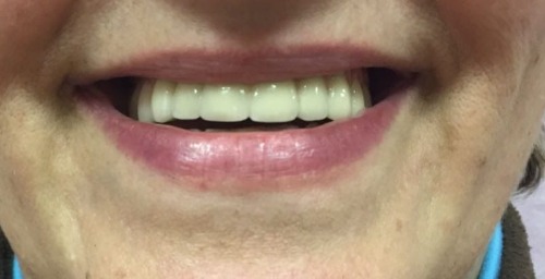 Trabajo3 Protésico dental  en MADRID Madrid - Fernando Hita