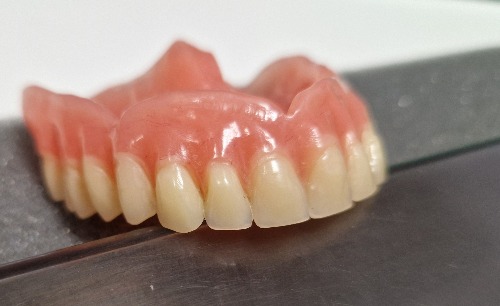 Trabajo4 Fernando Hita - Protésico dental  en MADRID Madrid