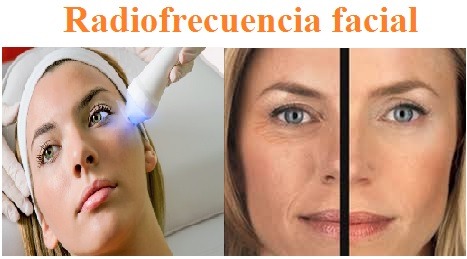 Trabajo4 Mercy Fre - Estética y uñas de porcelana  en LAS PALMAS de Gran Canaria Las Palmas