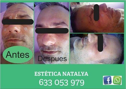 Trabajo1 Masajista, estética avanzada, depilación con cera  en Gijon Asturias - Natalya Azarova