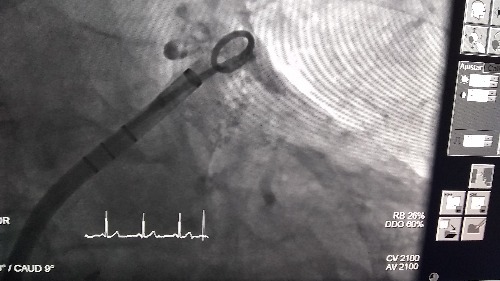 Trabajo4 Dra María Del Rosario Palomera Flores - Cardiólogo   internista ecocardiógrafista  en Zapopan Guadalajara